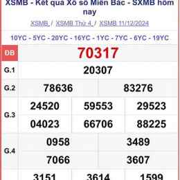 xổ số 11/7
